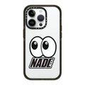 Eyes on you | iPhone 14 Pro / Impact Case / Black | Image 1